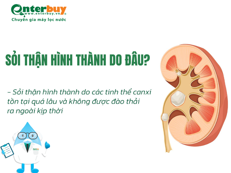 Sỏi thận hình thành do đâu?